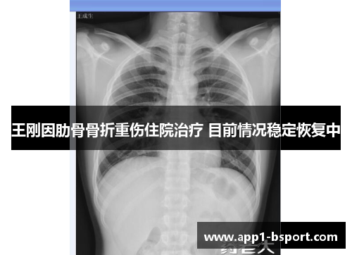 王刚因肋骨骨折重伤住院治疗 目前情况稳定恢复中 王刚因肋骨骨折重伤住院治疗 目前情况稳定恢复中